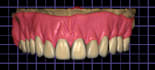 make dentures on exocad