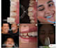 do a professional video editing on your dental cases