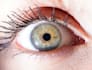 professional eye iris sharpening enhancement