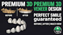 design 3d printed and milled veneers