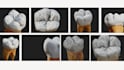 create a 3d medical model