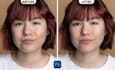retouch your skin, remove your pimples, acne retouching