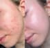 solve your skin and hair problem