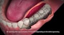 do 3d dental animation, 3d medical animation, surgery animation and 3d animation