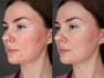 do pro face retouching, face and body slimming in 2 hours