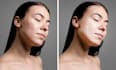 retouch your skin, remove your pimples and acne in photoshop