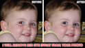 remove red eye, red eye removal