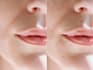 photoshop, body retouching, skin retouching, photo edit