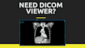 develop dicom viewer or customize ohif