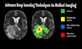 do medical imaging processing with ml, dl, computer vision