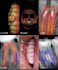 stand out with stunning dental motion graphics and animations