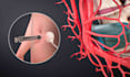 do 3d visualization medical animation