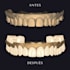 design a diagnostic waxup in exocad