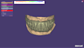 design a full mouth hybrid prothesis on exocad