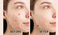do natural skin retouching without over smoothing