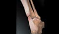 create 3d medical animation, anatomy, surgery animation, 3d explainer video