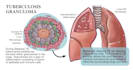 design and illustrate a medical illustration