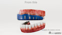 3d dental animation orthodontic animation 3d gum disease video medical animation