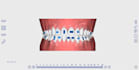 do dental clear aligners treatment planning,setup design on onyxceph software