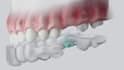 do 3d dental animation, 3d implant animation, 3d surgery animation, 3d medical