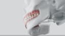 do 3d medical animation 3d surgery animation 3d explainer video