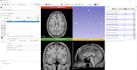 segment anatomical structures from nifti dicom images using 3d slicer