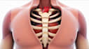 do 3d medical animation 3d medical device animation 3d surgical explainer video
