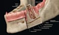 create precise orthopedic 3d medical animations