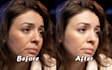 retouch and remove wrinkles, acne, scars and more for a flawless, natural look