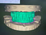 design all on x implants  using exocad 1 hour delivery