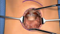 3d medical animation, anatomy explainer, surgery procedure animation, 3d surgeon