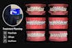 do predictable clear aligners treatment planning