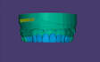 design high quality dental restorations using exocad