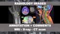 deliver a radiology second opinion report from an expert radiologist