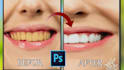 edit your teeth, align, whiten teeth, and remove braces