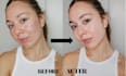 retouch your skin ,remove your pimples and acne