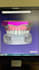 digital dental cad design, aligners, implants, dentures