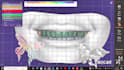 install and setup exocad dentalcad 3,3 chemnitz version