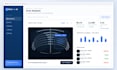 build a medical imaging ai model to detect diseases from x rays and mris