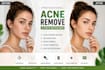 remove professionally acne or retouching your photos