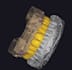 create accurate dental prosthesis designs using exocad