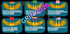 grin  premium teeth libraries 2026