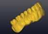 create  designs digital complete denture using exocad