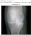 do medical imaging ai for disease classification by grad cam mri xray radiology