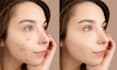 remove blemishes and smooth skin in a portrait