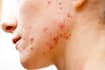 solve your skin issues as a board certified dermatologist