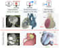 perform medical imaging segmentation and 3d visualization for ct mri