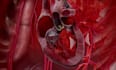 do 3d medical animation, 3d medical video, surgery animation, 3d anatomy