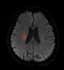 image segmentation, annotation, medical imaging