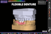 design partial dentures in exocad
